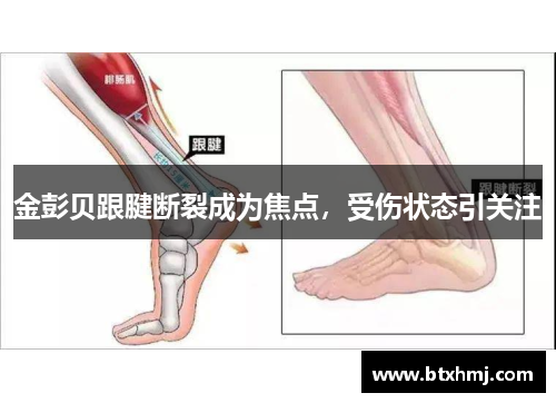 金彭贝跟腱断裂成为焦点，受伤状态引关注